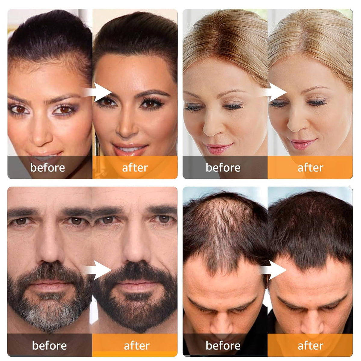 Couvre-racines pour une beauté sans effort