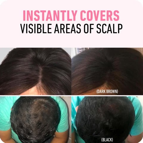 Couvre-racines pour une beauté sans effort