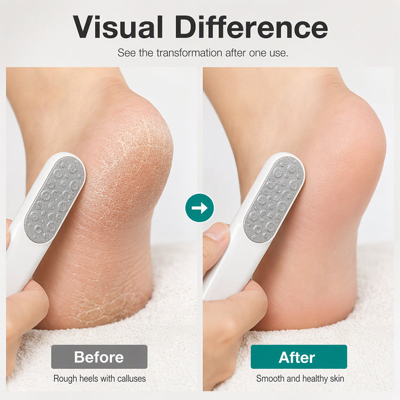 Râpe Double Face Anti-Callosités pour les Pieds